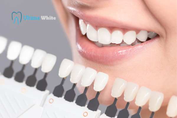 How to Maximise the Results of Your Laser Teeth Whitening Treatment Hempstead