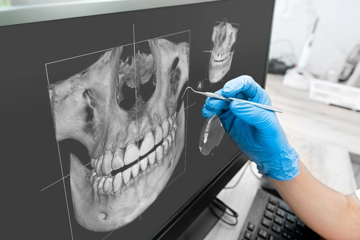 Key Benefits of 3D Printing for Patients and Dentists Hempstead