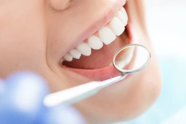 How to Maintain Your Whiter Smile After Treatment Hempstead