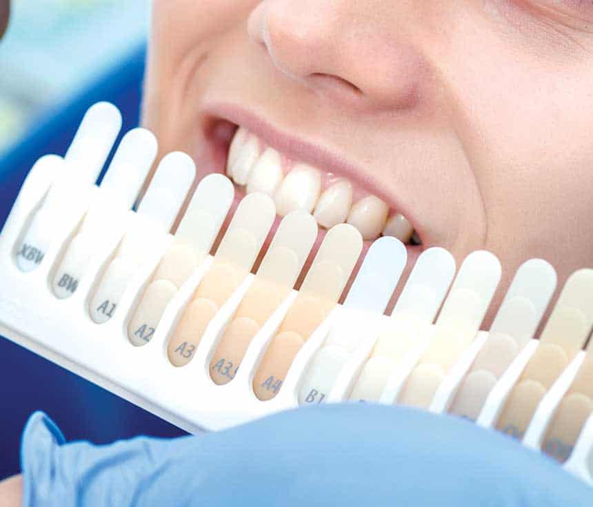 Is Laser Teeth Whitening Worth It for a Brighter, Confident Smile Hempstead?