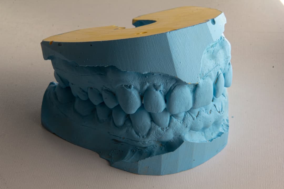 How Do Dental Implants Improve Jawbone Health and Oral Function Hempstead?