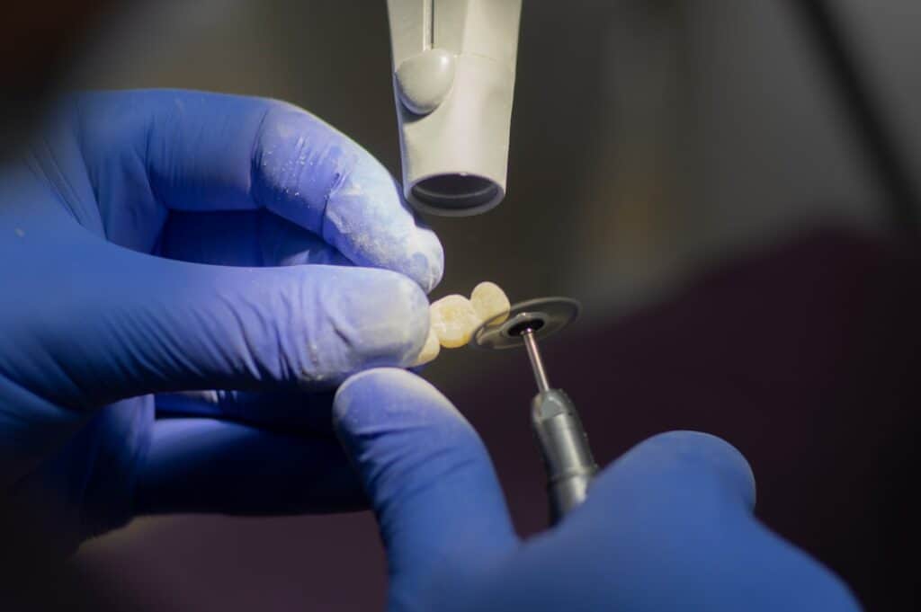 Customised Dental Solutions: Crowns, Aligners, and Implants Hempstead