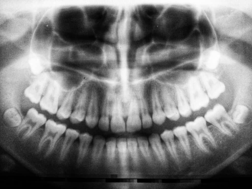 The Future of 3D Printing in Oral Healthcare Hempstead